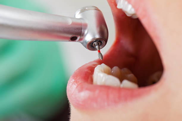 Best Emergency Cosmetic Dentistry (e.g., broken veneers) in Santa Fe, NM